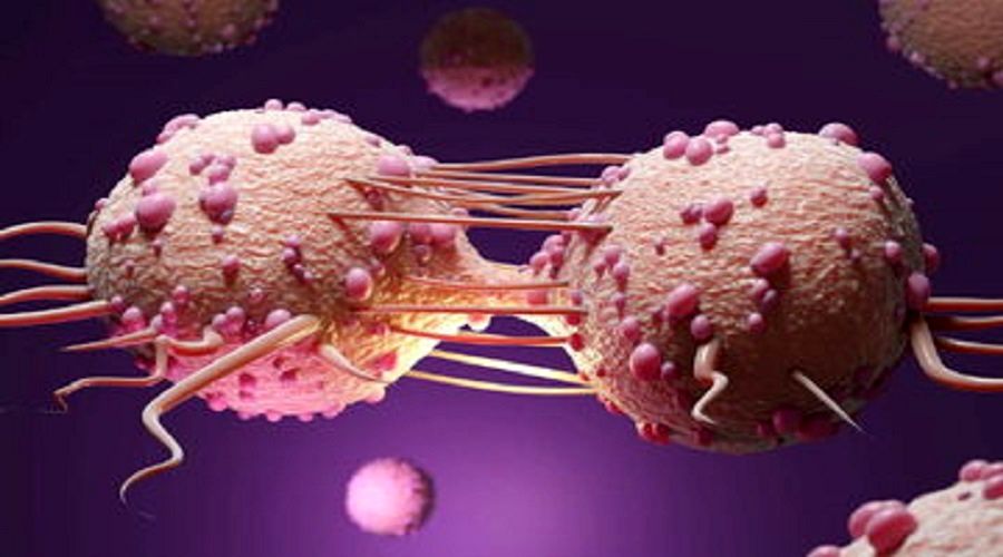 افزایش نگران کننده ابتلا به سرطان در افراد زیر ۵۰ سال در جهان