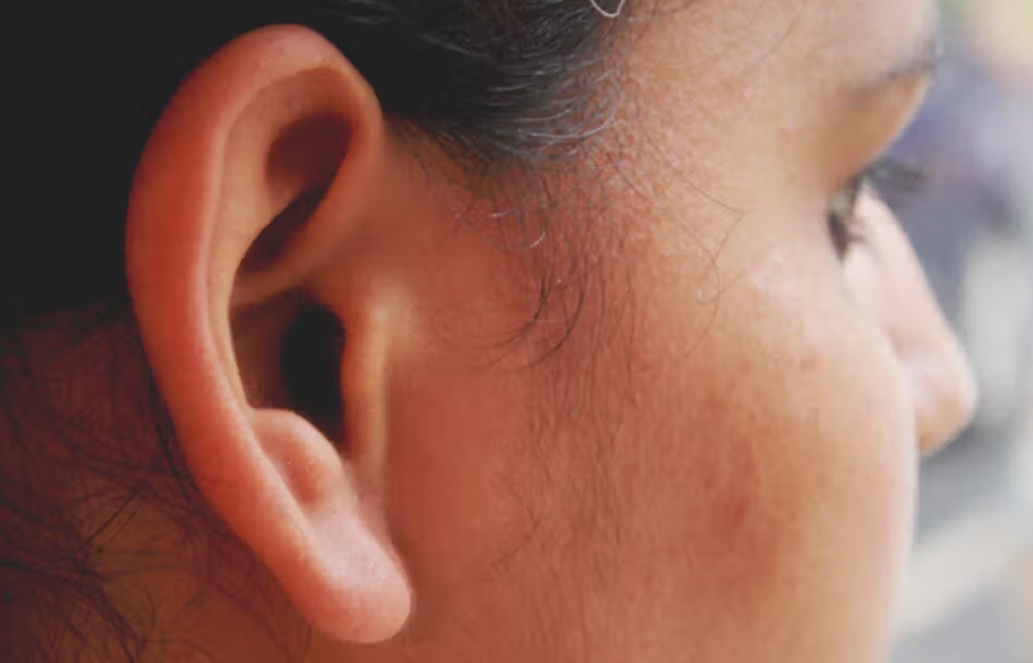 علت بوی بد پشت گوش چیست؟