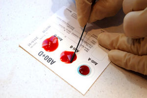 دارندگان این گروه خونی زیاد تر در خطر سکته می باشند