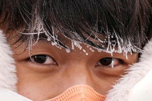 رابطه بین هوای سرد و سکته مغزی