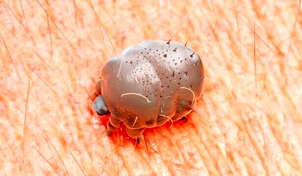 شیوع یک بیماری مُسری در انگلیس