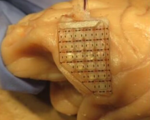 پیشگیری از اعتیاد به قمار با کاشت یک تراشه در مغز!/ عکس