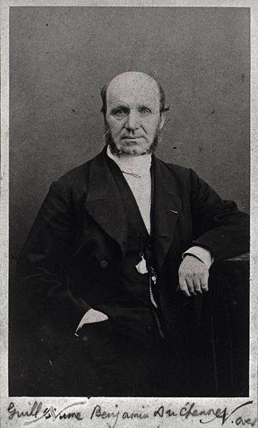 لبخند دوشن ؛ از الگویی برای لبخند واقعی تا تحقیقاتی که روی سرهای بریده انجام می شد! 14 لبخند دوشن ؛ از الگویی برای لبخند واقعی تا تحقیقاتی که روی سرهای بریده انجام می شد! (+عکس)