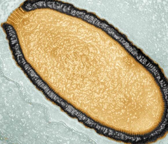 دعوا ویروس زامبی مدفون در اعماق یخ‌ها، چه مقدار محتمل است؟