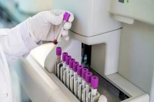 تشخیص سرطان از یک قطره خون طی چند دقیقه_آینده