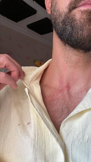 Img20240429202224586