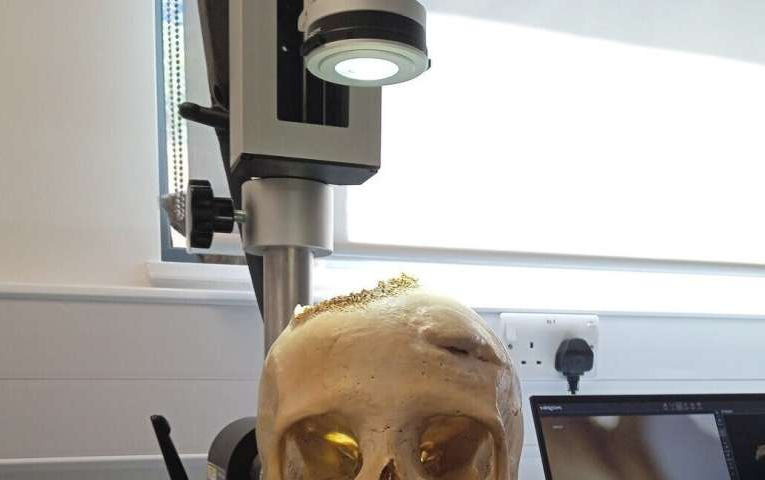 تلاش پزشکان مصر باستان برای درمان سرطان_آینده