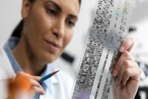 محققان توانستند ۱۲ ژن عامل سرطان سینه در زنان را شناسایی کنند_آینده