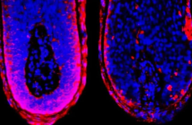 توقف ریزش مو با مسدود کردن یک مکانیسم زیستی_آینده