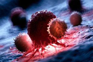 آخر کارآزمایی بالینی روی نانوداروی ضدسرطان حاوی RNA_آینده