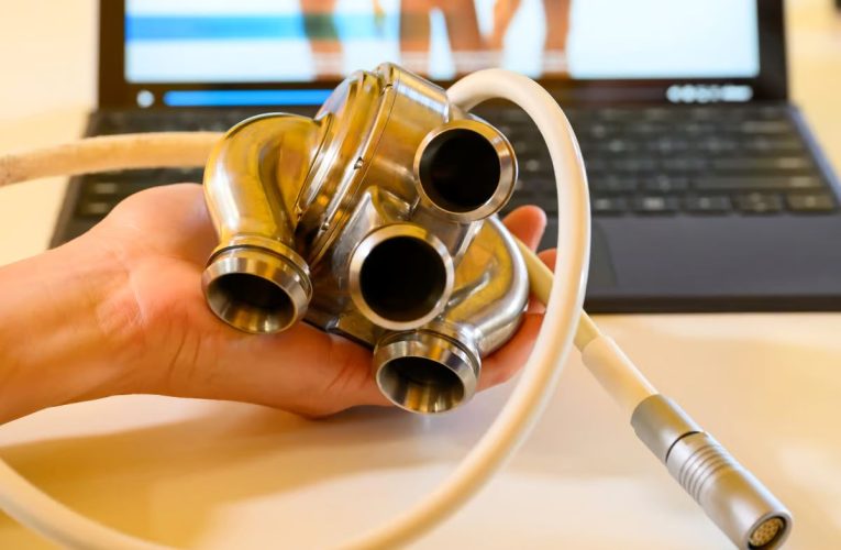 اولین قلب تیتانیومی جهان با پیروزی در بدن انسان کاشته شد_آینده