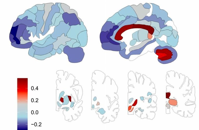 دانشمندان برای اولین بار از توزیع لیپید در مغز انسان نقشه‌برداری کردند_آینده