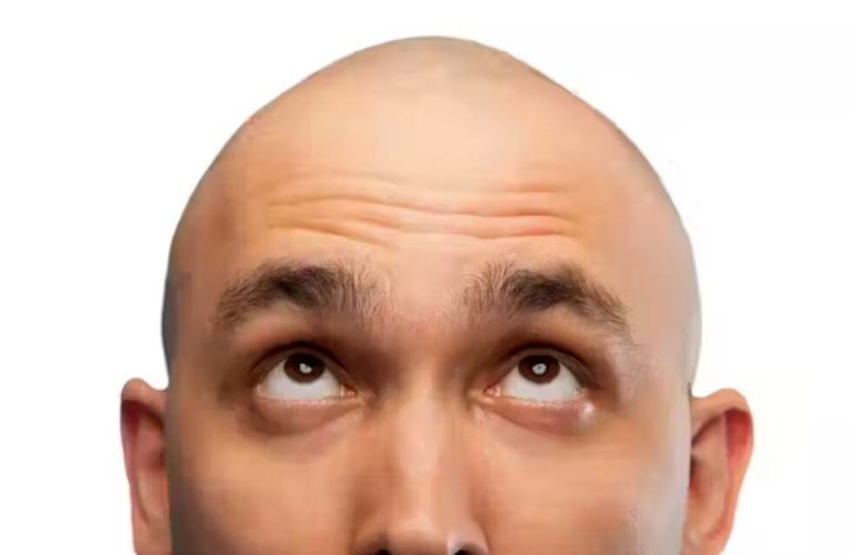 دیگر فردی در آینده طاس نمی‌شود_آینده