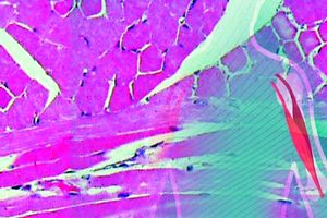 ساخت یک مولکول تازه برای دارورسانی به عضلات اسکلتی_آینده