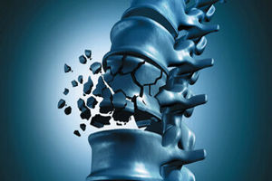 مقابله با پوکی استخوان با این خوراکی خوشمزه_آینده