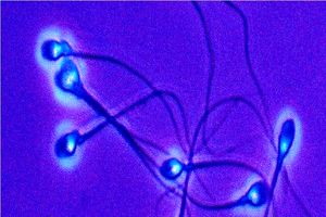 کشف تغییرات مرموز اسپرم‌ها متاثر از ویروس HPV_آینده