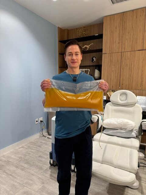 میلیاردر آمریکایی در سودای جوانی پلاسمای بدنش را معاوضه کرد!/ تصاویر_آینده 14 3