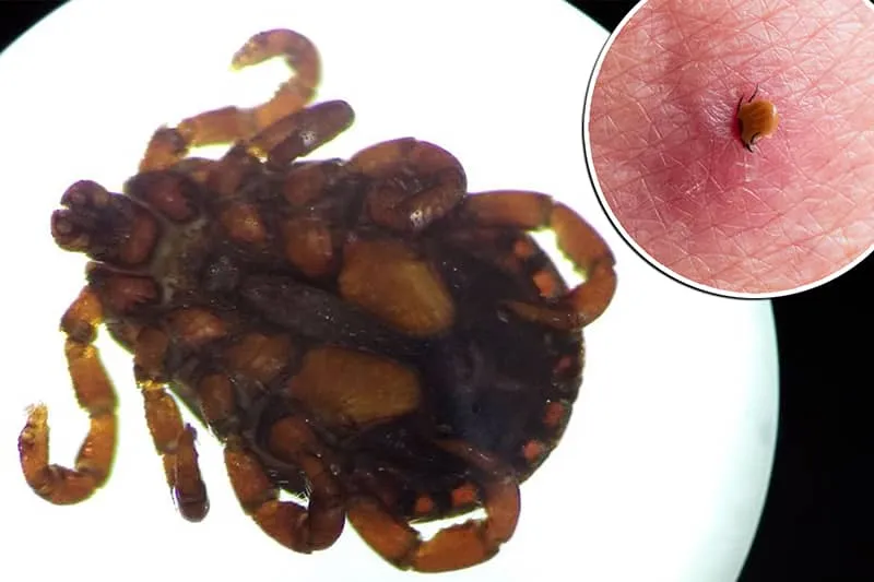 کشف یک ویروس ناشناخته در چین که همه را نگران کرده است