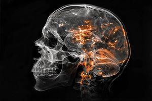 کشف منشأ تشکیل هراس و اضطراب در مغز؛ بارقه امیدی برای یافتن درمان_آینده