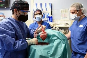 امیدی تازه در علم پزشکی؛ زنی با کلیه خوک رکورد طویل‌ترین زندگی با عضو حیوانی را شکست_آینده