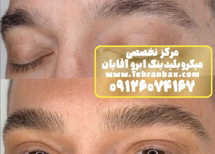 چرا آقایان میکروبلیدینگ ابرو انجام می‌دهند؟