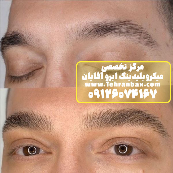 چرا آقایان میکروبلیدینگ ابرو انجام می‌دهند؟
