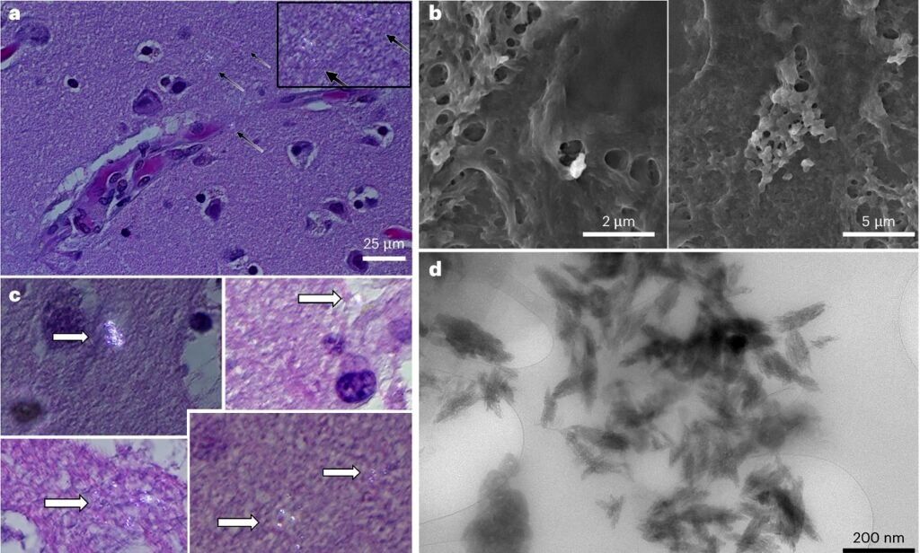 مقدار تجمع نانوپلاستیک در مغز انسان معادل یک قاشق است_آینده 13 نانوپلاستیک در مغز