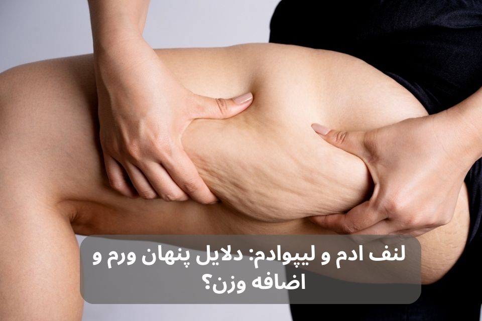چرا وزن من بالا می‌رود؟ دلایل و راه‌حل‌ها