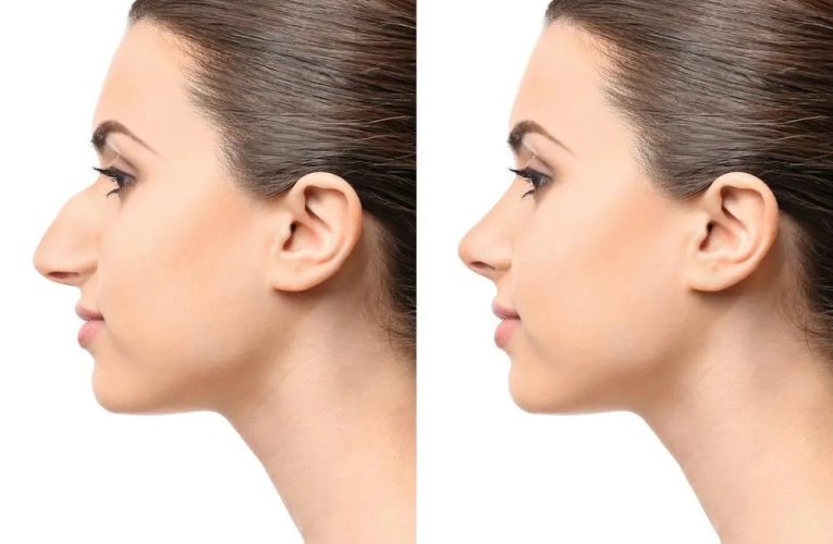روش‌های جدید در تکنیک‌های جراحی بینی ترمیمی