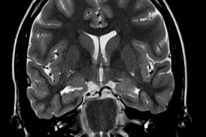 سلول‌های مغزی انسان سریع‌تر از هوش مصنوعی یاد می‌گیرند