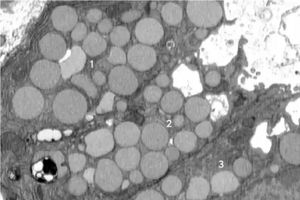 کشف مکانیسم عجیبی در بدن؛ سلول‌ها برای جوان شدن «استفراغ» می‌کنند!