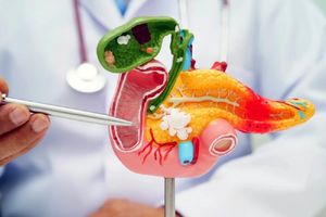 نقطه ضعف سرطان لوزالمعده کشف شد