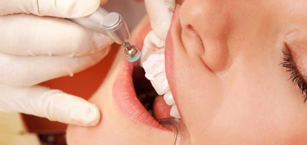 لبخندی که همه چیز رو تغییر میده؛ راهنمای کامل مراقبت و درمان های دندانپزشکی 20 لبخندی که همه چیز رو تغییر میده؛ راهنمای کامل مراقبت و درمان های دندانپزشکی