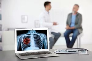 پرتودرمانی، جایگزینی قوی برای جراحی در سرطان ریه