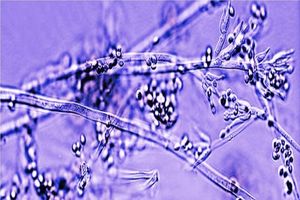 بانداژهای ساخته شده از قارچ‌های زنده؛ آینده‌ التیام زخم