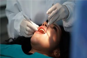 پژوهشگران ایرانی مقیم آمریکا «چاپ ۳بعدی روکش دائمی دندان ظرف چند ساعت» را محقق کردند_آینده