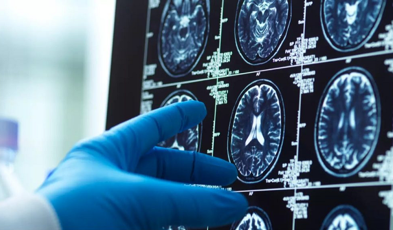 اوج کارکرد مغز انسان در چند سالگی است؟_آینده