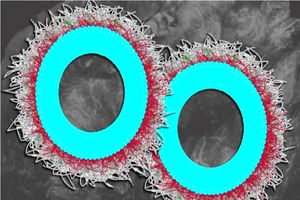 نابودی بیشتر از ۸۰ درصدی تومورهای تخمدان با نانوذرات جدید_آینده