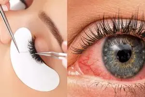 هشدار محققان درباره اکستنشن مژه؛ زیبایی که می تواند به قیمت نابینا شدن تمام شود