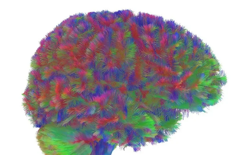 ۵ دوره ساختاری مغز؛ کشف نقاط عطف سیم کشی عصبی از تولد تا کهنسالی/ تصاویر_آینده