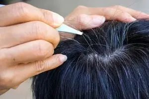 طب سنتی در مورد علت سفیدی مو چه می‌گوید؟