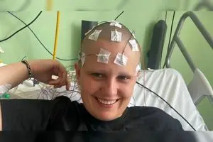 «چت‌جی‌پی‌تی» بیماری نادر یک زن را تشخیص داد