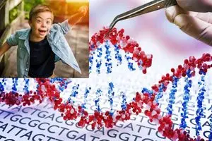 گام جسورانه فناوری کریسپر برای خاموش کردن کلید سندرم داون
