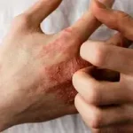 درمان های خانگی برای رفع خشکی پوست